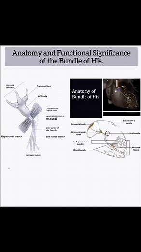 B.sc Nursing notes on Instagram: "The Bundle of His: The Heart’s Conduction Maestro ⚡🫀. The Bundle of His ensures synchronized heart rhythm: Origin: Emerges from the AV node, piercing the fibrous skeleton. Pathway: Splits into left (anterior/posterior) and right bundle branches in the ventricular septum. Function: The only electrical link between atria and ventricles, it drives AV delay, prevents arrhythmias, and powers the Purkinje network for ventricular activation. #BundleOfHis #CardiacElect