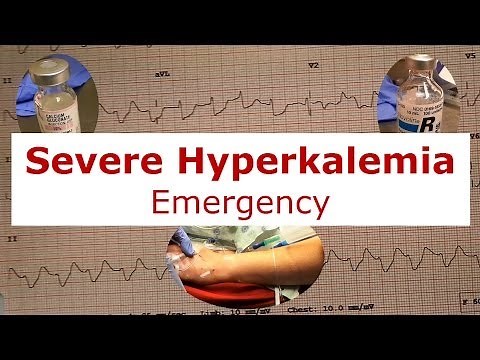 Severe Hyperkalemia Emergency