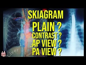 Thorax Radiological Anatomy | Plain, Contrast Skiagrams | Chest X-Ray | Anatomy Decoded