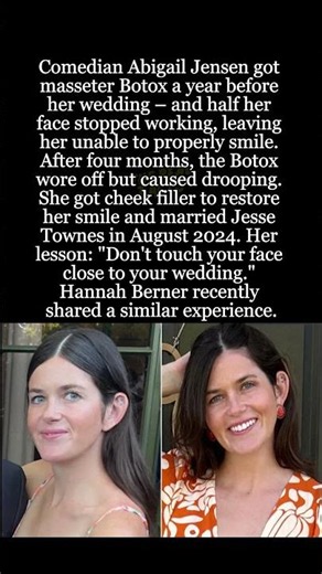 Bride's Botox Nightmare – Half Her Face Stopped Working Before Wedding! #shorts #AbigailJensen