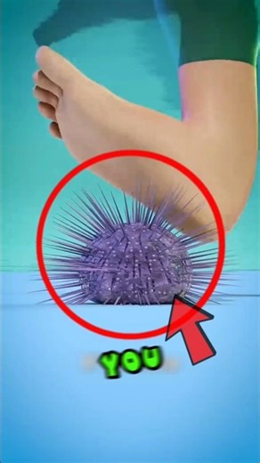 Step on a Sea Urchin? Don’t Use Tweezers—Do This Instead. #shorts