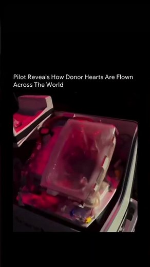 Heart beating OUTSIDE the body... #doctor #emergency