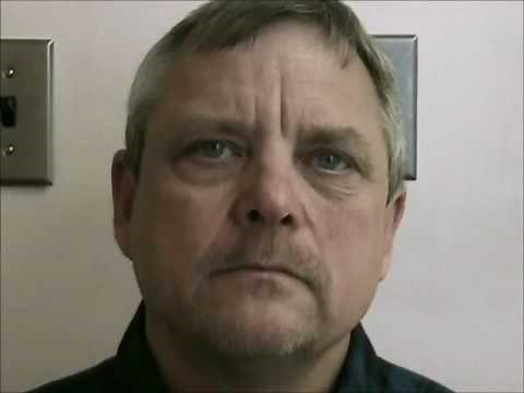 Babinski's brow lift sign