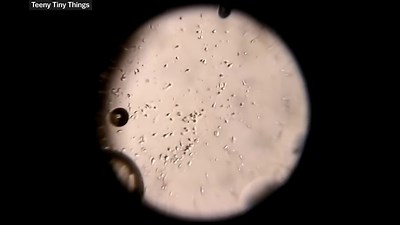 The remarkable discovery of microbial life