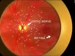 What is Retina : Patient Education