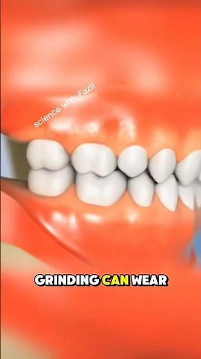 Teeth Grinding Damage: How Bruxism Slowly Destroys Your Teeth 😬🦷 (3D Animation) #Bruxism