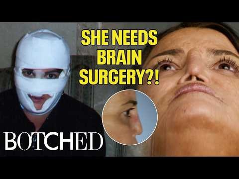 An Undetected Brain Aneurysm?! Dr. Nassif Saves Luci's Life and Nose (Before & After) | Botched | E!