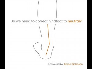 Hindfoot alignment explained by Simon Dickinson