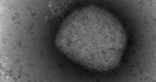 Monkeypox in the U.S.: What we know about the 19 cases identified so far