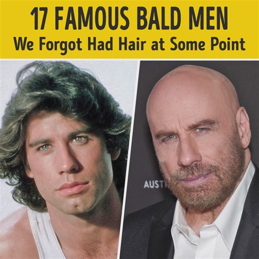 414K views · 2.5K reactions | 70+ Stars Who Drastically Changed Their Hair | Bright Side | Facebook