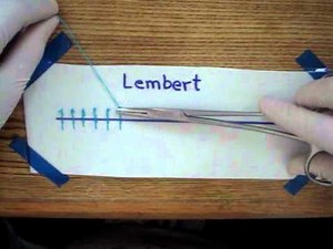 Lembert 5