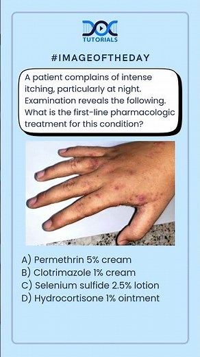 Intense Itching at Night: What is the first-line pharmacologic treatment for this condition?