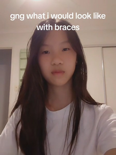 cant really see them, pretty or not? getting them next wednesday btw😭✌️tagging everyone i know #braces #anxiety #insucurities #elenawang @BLΛƆKPIИK @JENNIE @ROSÉ @Omeletee @່ @𝐌𝐀𝐃𝐃𝐈𝐄 @SB🔛🔝 @Kate the great @SaLsA @ian @Alien Wong @DaBabyfacedassassinHunter🏀🎧 @driraa @Grace @Haadethegoat @Infinitez97 @Isabella. @just_heidi @kina @Sarah @sophia @susan jiang @Tithi @༄ @ꨄ︎ᥫ᭡ @allabout_d3von♠️🪄💸 @