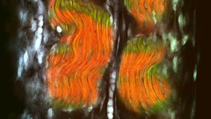 Second harmonic generation microscopy gets better contrast