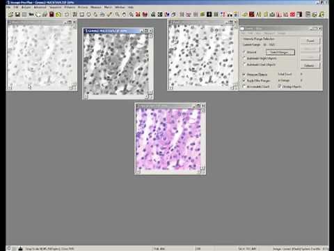 Threshold Color Images - Image-Pro Plus Software