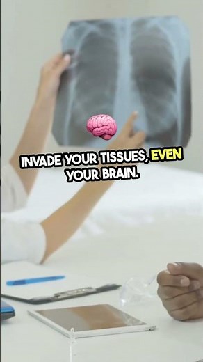 Understanding Taeniasis: The Impact of Tapeworm Infection on Human Health