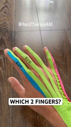 Which 2 Fingers Have an Extra Extensor Tendon?