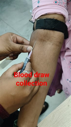 blood collection technique ✅ | blood draw process