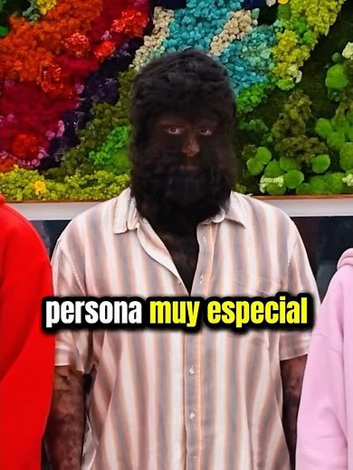 Stokes Twins Conocen al Hombre Más Peludo del Mundo😳