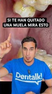 ¿Por qué te quieren quitar también la MUELA del JUICIO de arriba?