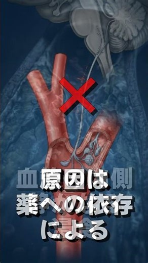 その高血圧の薬、飲み続けると危険です【薬剤師解説】