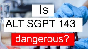 Is ALT SGPT 143 high, normal or dangerous? What does Alanine aminotransferase level 143 mean?