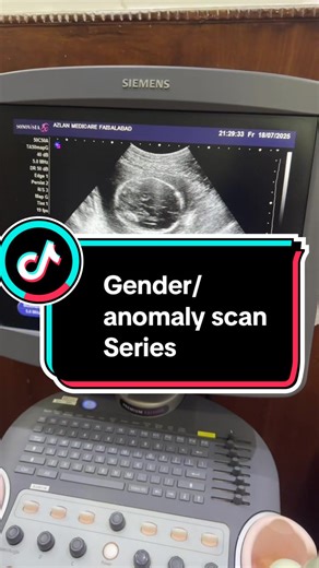 Gender Anomaly Scan Services in Faisalabad