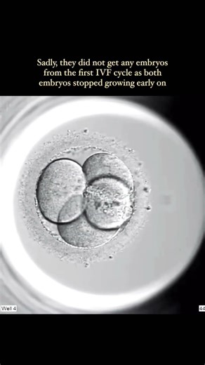 Proof IVF Change Life | IVF Story You Need to See | Science Gave Them a Baby | IVF Success | Part 3