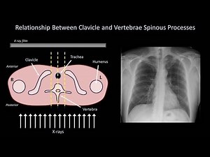 How to Interpret a Chest X-Ray (Lesson 3 - Assessing Technical Quality) • Video • MEDtube.net