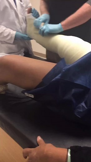 Leg Cast Adjustment by Medical Professionals