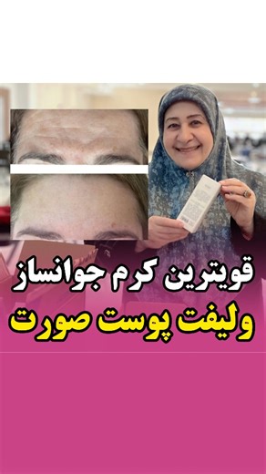 ‎پوست| چین و چروک| لیفت| لک|جوش‎ on Instagram‎: "با استفاده ازاین کرم تمامی چین وچروک های پوستت برطرف میشه پوست شفاف روشن میشه جوانسازی روی پوست شما اتفاق میوفته خانم آقا هم نداره برای اطلاعات بیشتر این کرم عدد ۵ رو کامنت کنید ولی باید پیج منو فالو داشته باشید malake_poust 09906947819 موبایل #جوانسازی #پوست_درخشان #چین_چروک #زیبایی #اکسپلور"‎