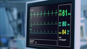 Heart Rate Monitor Hospital Theater Medical Stock Footage Video (100% Royalty-free) 1062311950 | Shutterstock