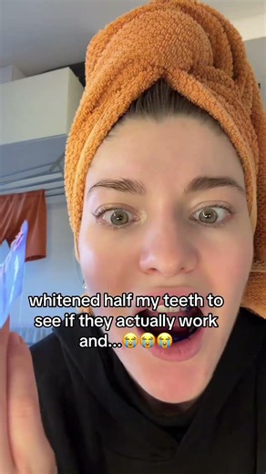 Daamn.. 😭 #teethwhitening #glowup #dentalcare #teethtok #usa #uk #whiteningstrips #funny #fyp