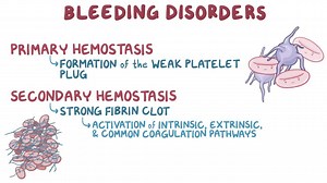 Video: Bleeding disorders: Clinical - Video Explanation! | Osmosis | Osmosis