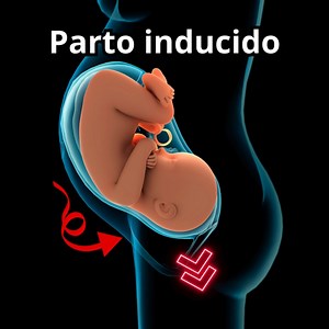 495K views · 6.3K reactions | Parto inducido掠 Aqui te mostramos el proceso del parto y como se induce en casa o en hospital. | Madres y Embarazo Feliz | Facebook
