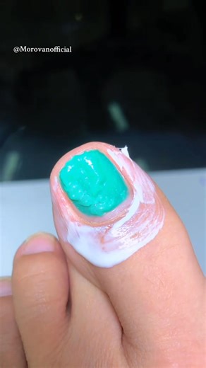 This One Step Gel Remover is a game changer for easy, quick gel removal! #nailspolish #nailsart #morovan #nailstutorial #polishnails | Morovanofficial