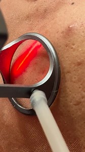 555K views · 316 reactions | The newest skincare craze ✨ | Lessons Learned In Life | Facebook