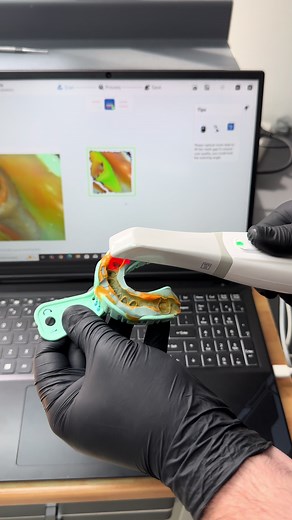 Impression scanning #dentistry #veneers #technology #fyp #zirconia #exocad #kosovo #prishtina #albania #tirana #ivoclar #dentista #scanner #intraoralscanner #dentallab #dentistry