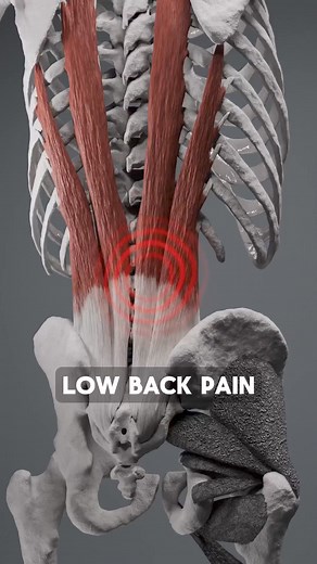 449K views · 8.1K reactions | What causes lower back pain? . ➤ To...