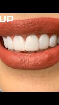 Close up Teeth Lips & Smile || Smile Makeover