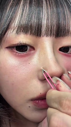 白ニキビを簡単にケアする方法
