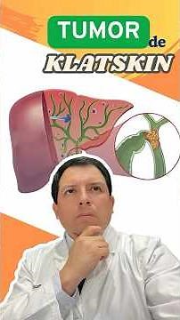 JAUNDICE, WEIGHT LOSS, AND DARK URINE? BE CAREFUL! IT COULD BE A KLATSKIN TUMOR #shorts