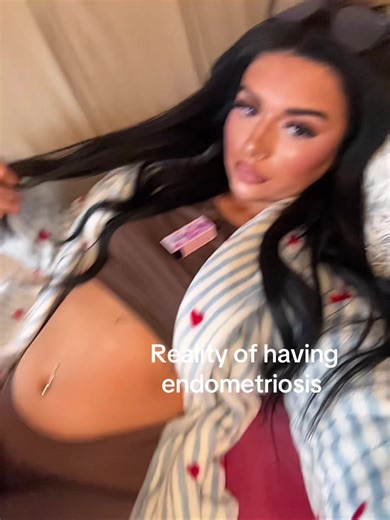 Understanding Endometriosis Flare-Ups