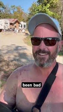 What to expect after rotator cuff surgery - the real recovery breakdown#Surgery #Shoulder #￼pain