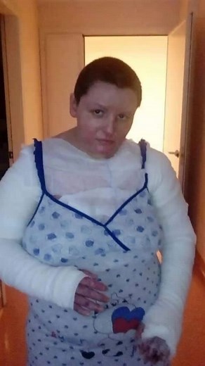 Exploring Life with an Arm Cast: Daily Moments