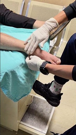 reduccion luxacion de tobillo 2 #dolor