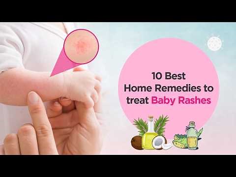 10 Best home remedies for baby diaper rashes | Dr. Pabiyasree J | Cloudnine Hospitals