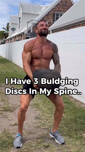 Steven Sahyoun | Rehab & Performance on Instagram: "Bulging discs in your spine don’t automatically mean you’re broken. Disc bulges are common on imaging and are often found in people with no back pain at all. It only really becomes a problem when symptoms are present. The spine is no different to any other structure in the body. It adapts to progressive load and it adapts to what you expose it to. #Backpain #strengthtraining #spinemobility #combatsports #mma"