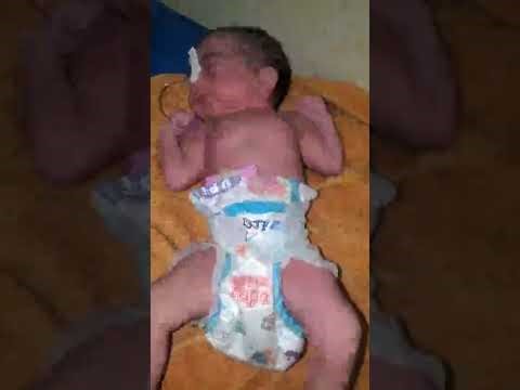 newborn baby in incubator NICU system for maintain the environment lot of crying newborn baby