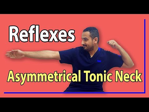 06 Asymmetrical Tonic Neck Reflex
